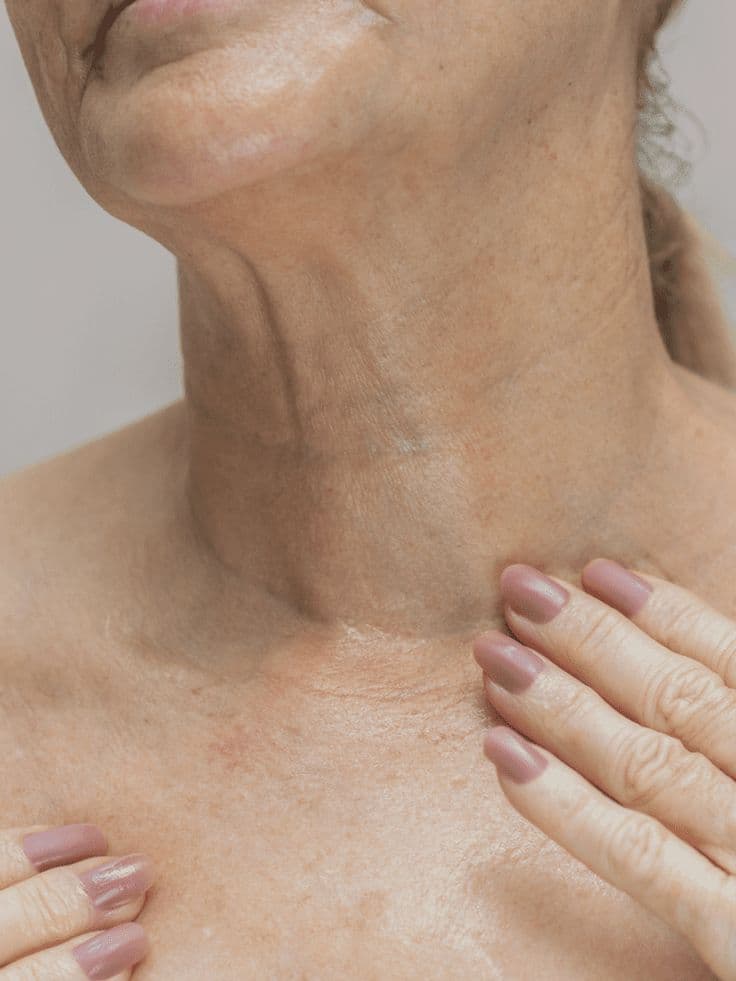 Nefertiti Neck Lift