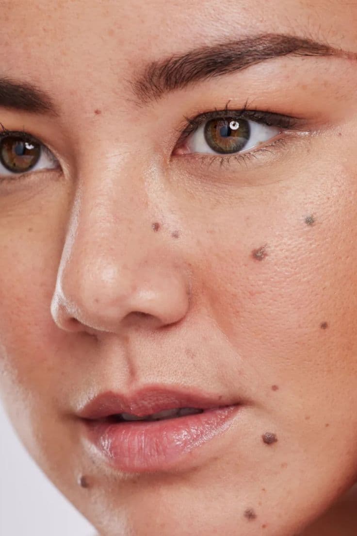 Map My Mole